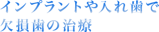 インプラントや入れ歯で 欠損歯の治療