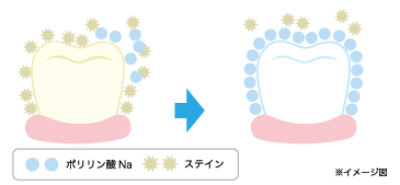 ポリリンホワイトニングのしくみ